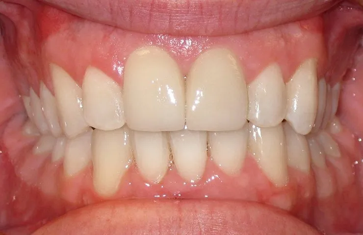 Schimmel Orthodontic Associates - Photo 2
