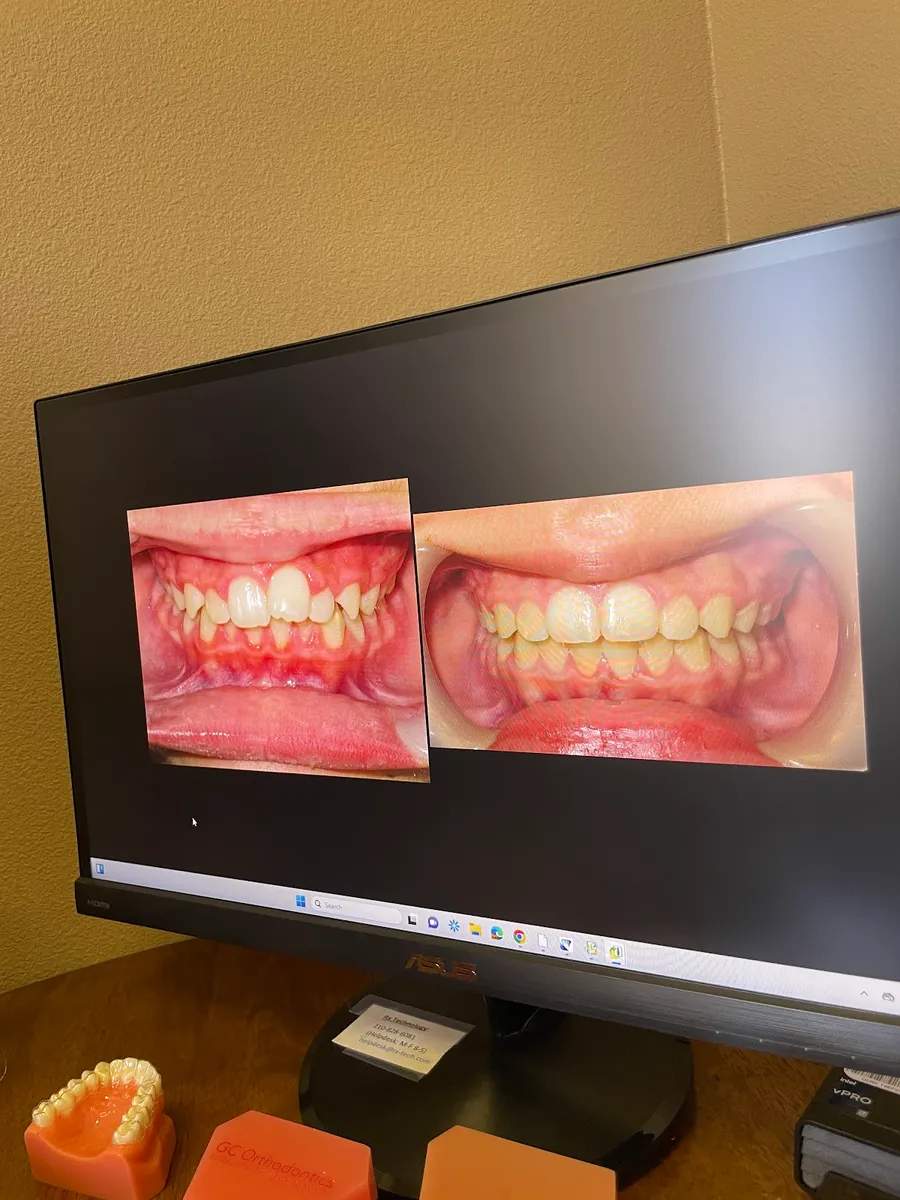 Hulme Orthodontics - Boerne - Photo 4