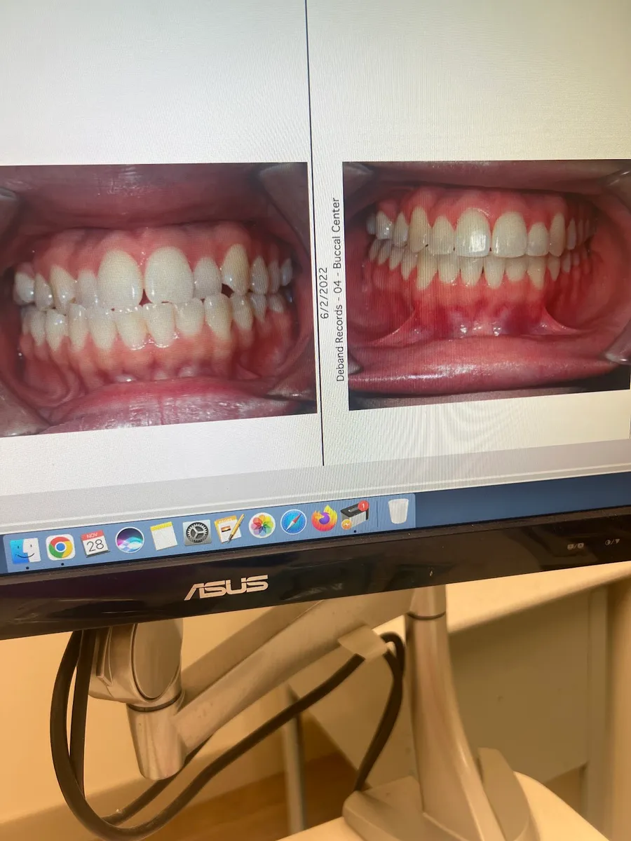 Hannon Orthodontics - Photo 4