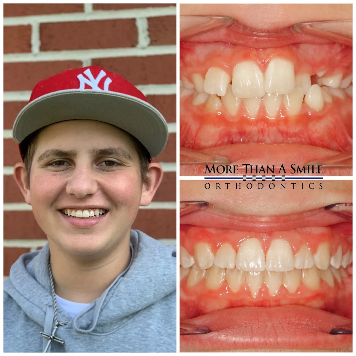 More Than A Smile Orthodontics - Photo 7