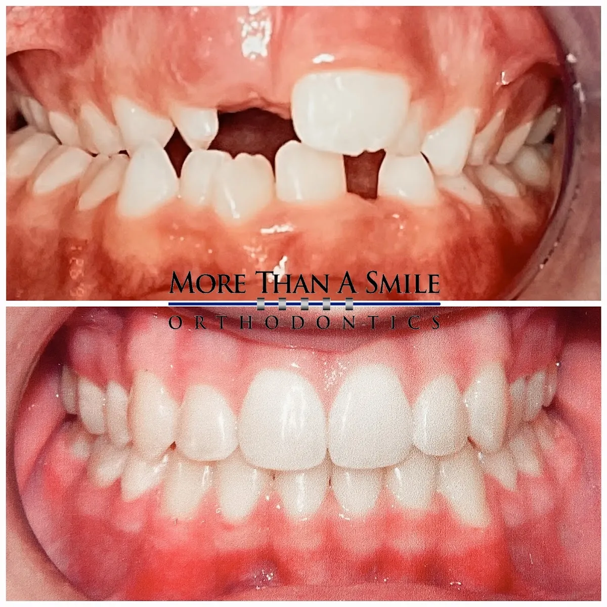More Than A Smile Orthodontics - Photo 6