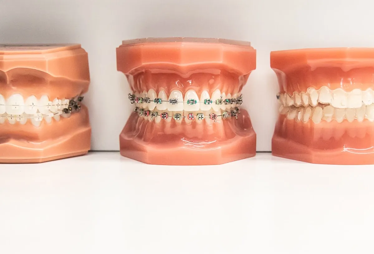 Modern Orthodontics - Photo 4