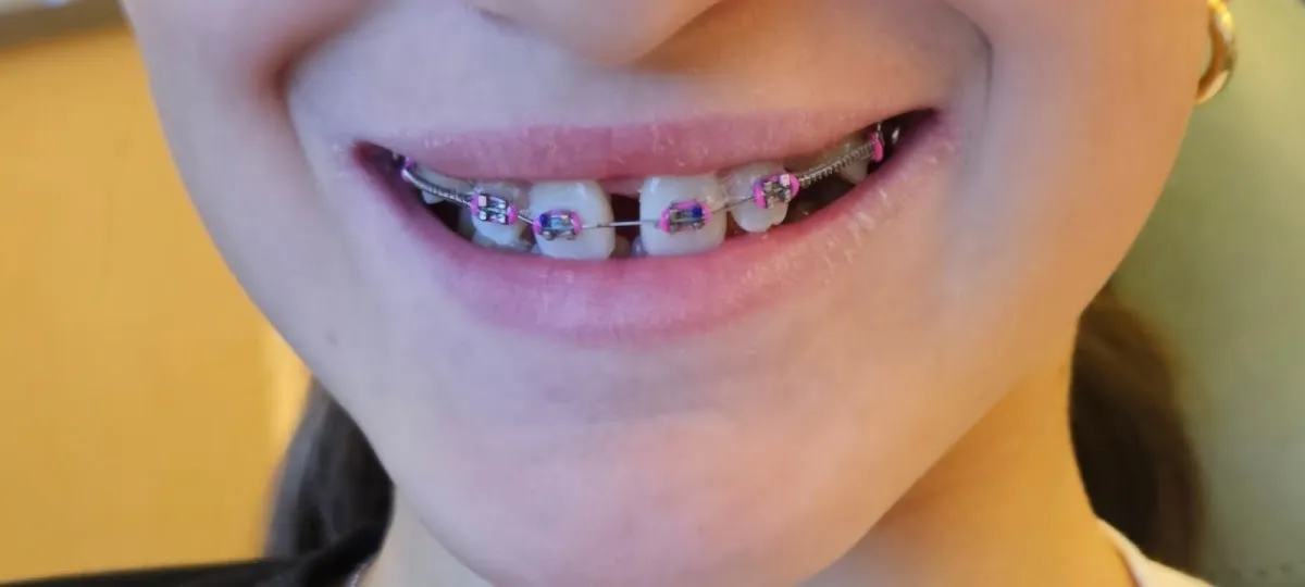 Gulf Coast Orthodontics - Fort Myers - Photo 3