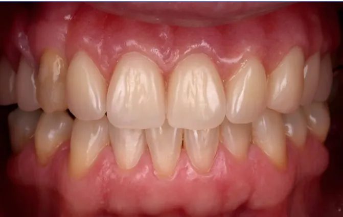 Boston Prosthodontics Dental Group - Orthodontist in Boston