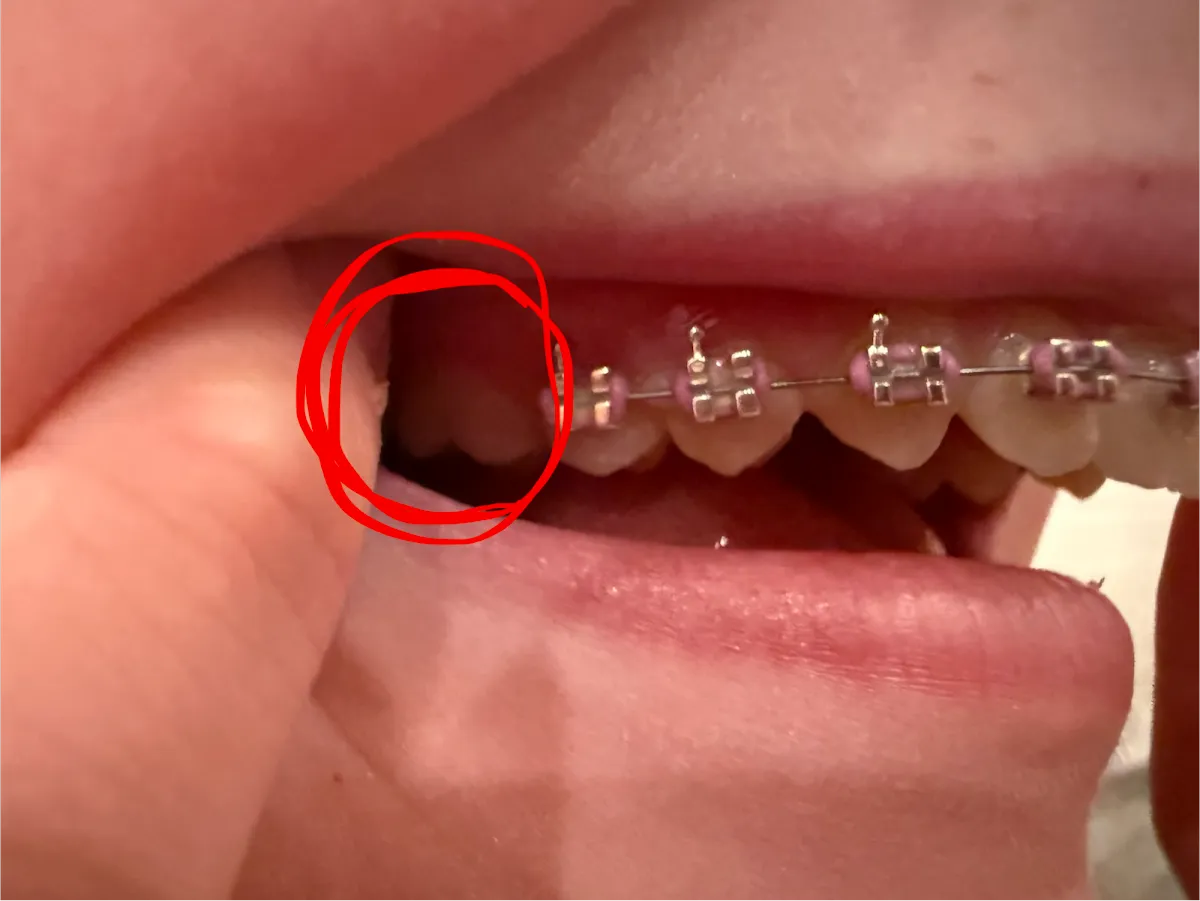 Rollins & Petersen Orthodontics - Photo 3