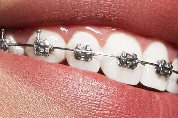 Winning Smiles Orthodontics