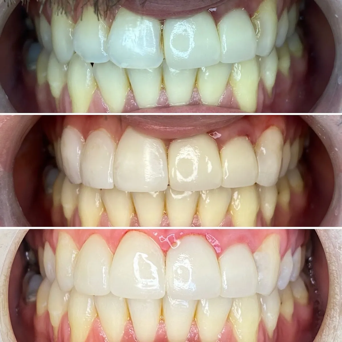 Modesto Lux Dental - Photo 5