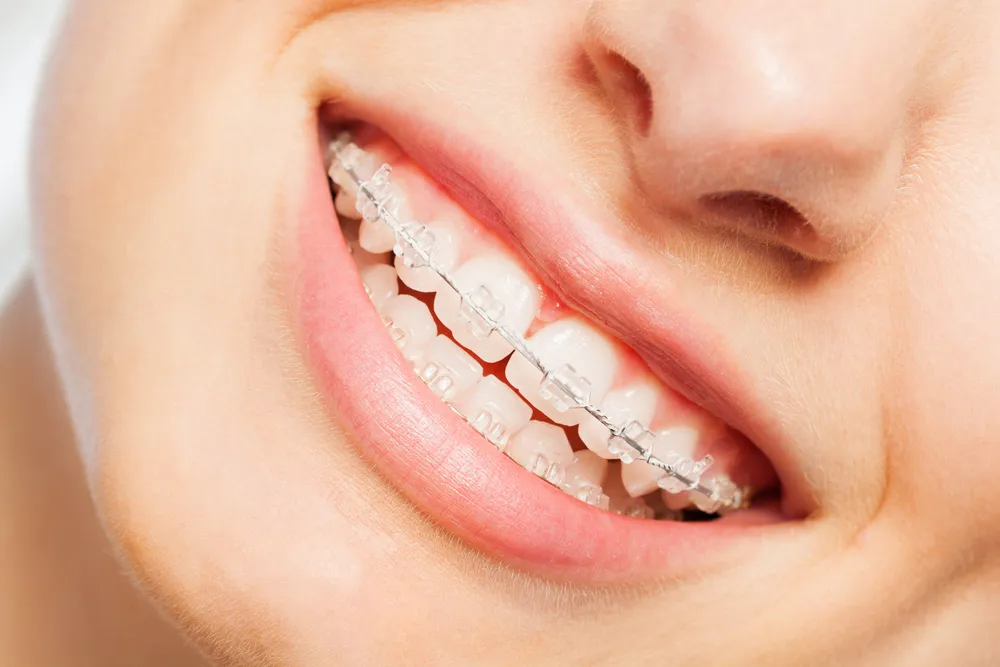 Legendary Smiles – Carson - Photo 2