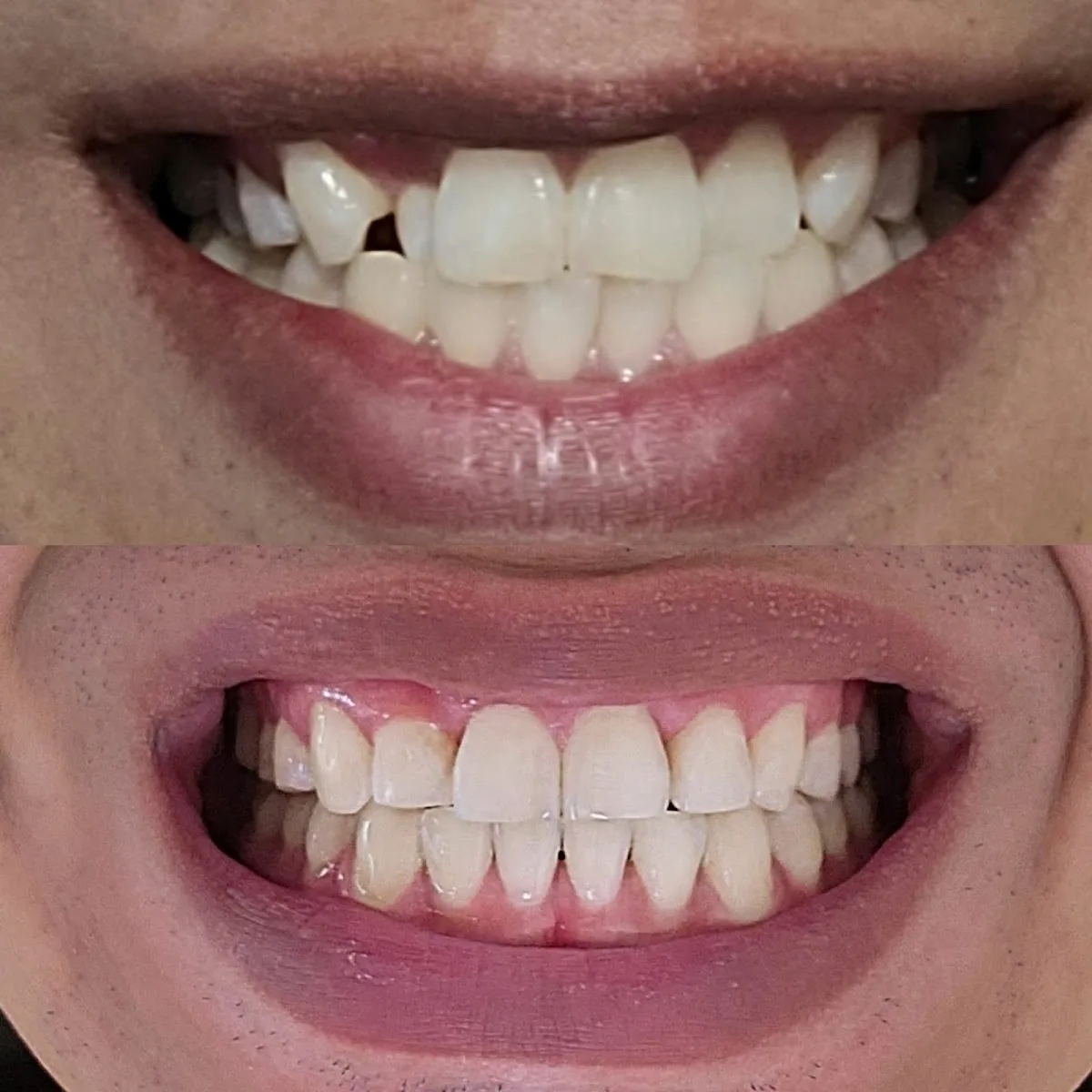 Zammitti & Gidaly Orthodontics - Harrisburg - Photo 5