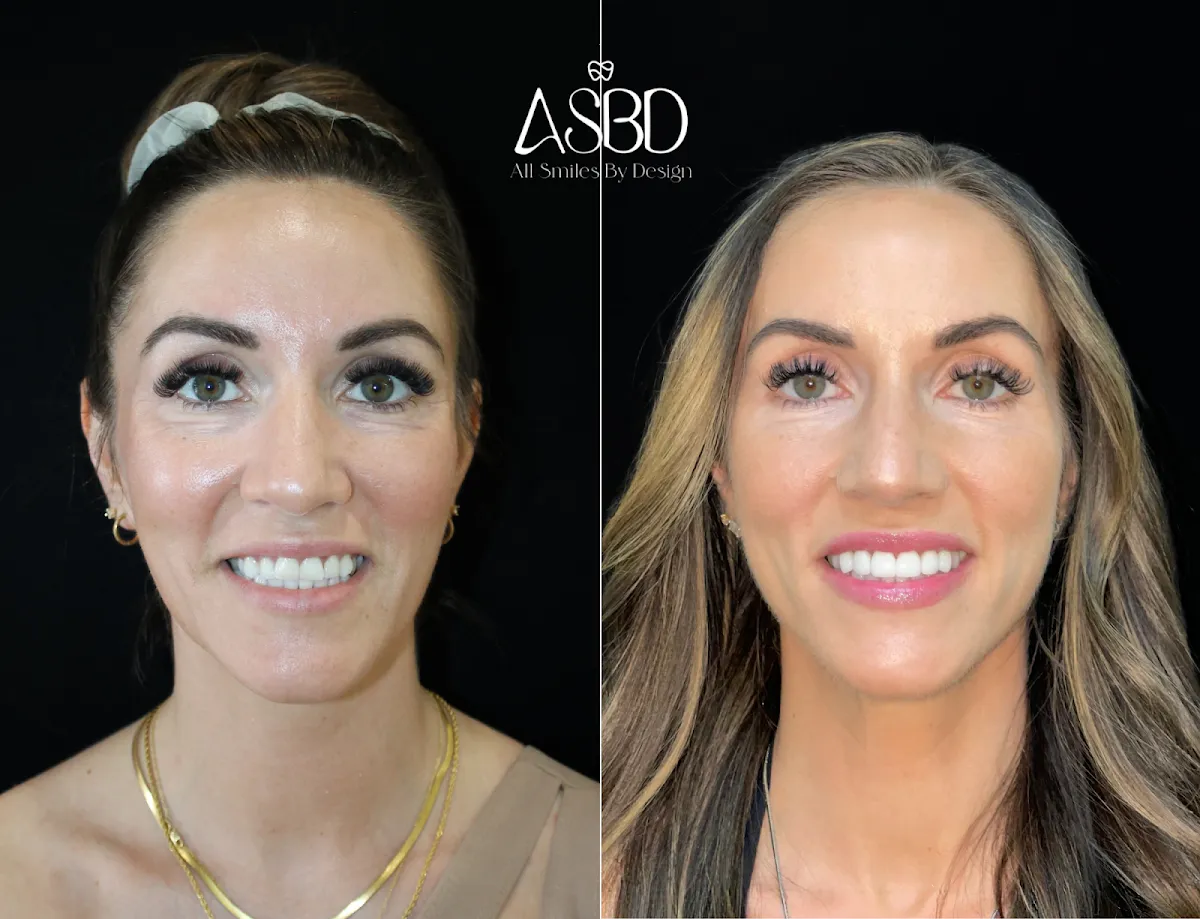 Dentist Henderson - All Smiles By Design