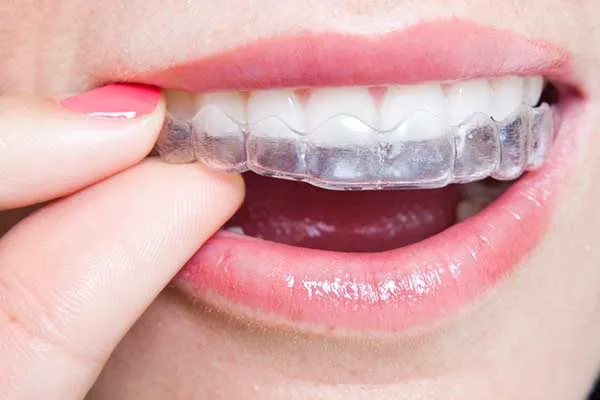 Island Orthodontics- Wailuku - Photo 5