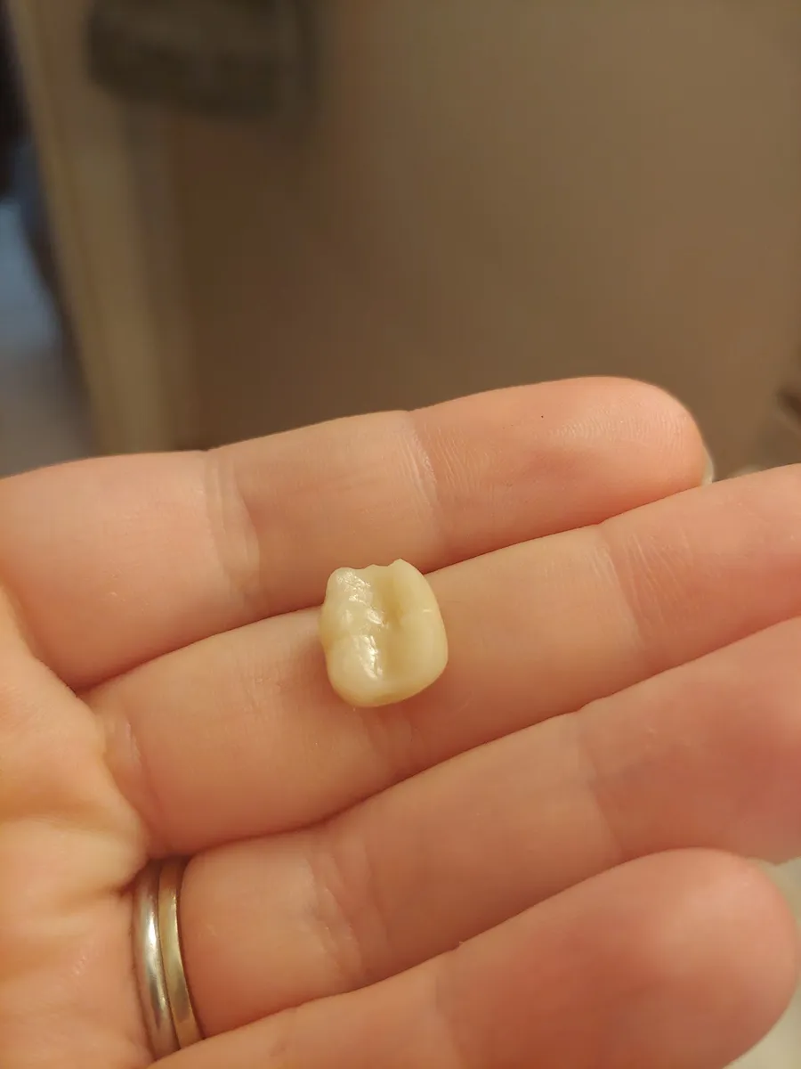 Aspen Dental - Niagara Falls, NY - Photo 3