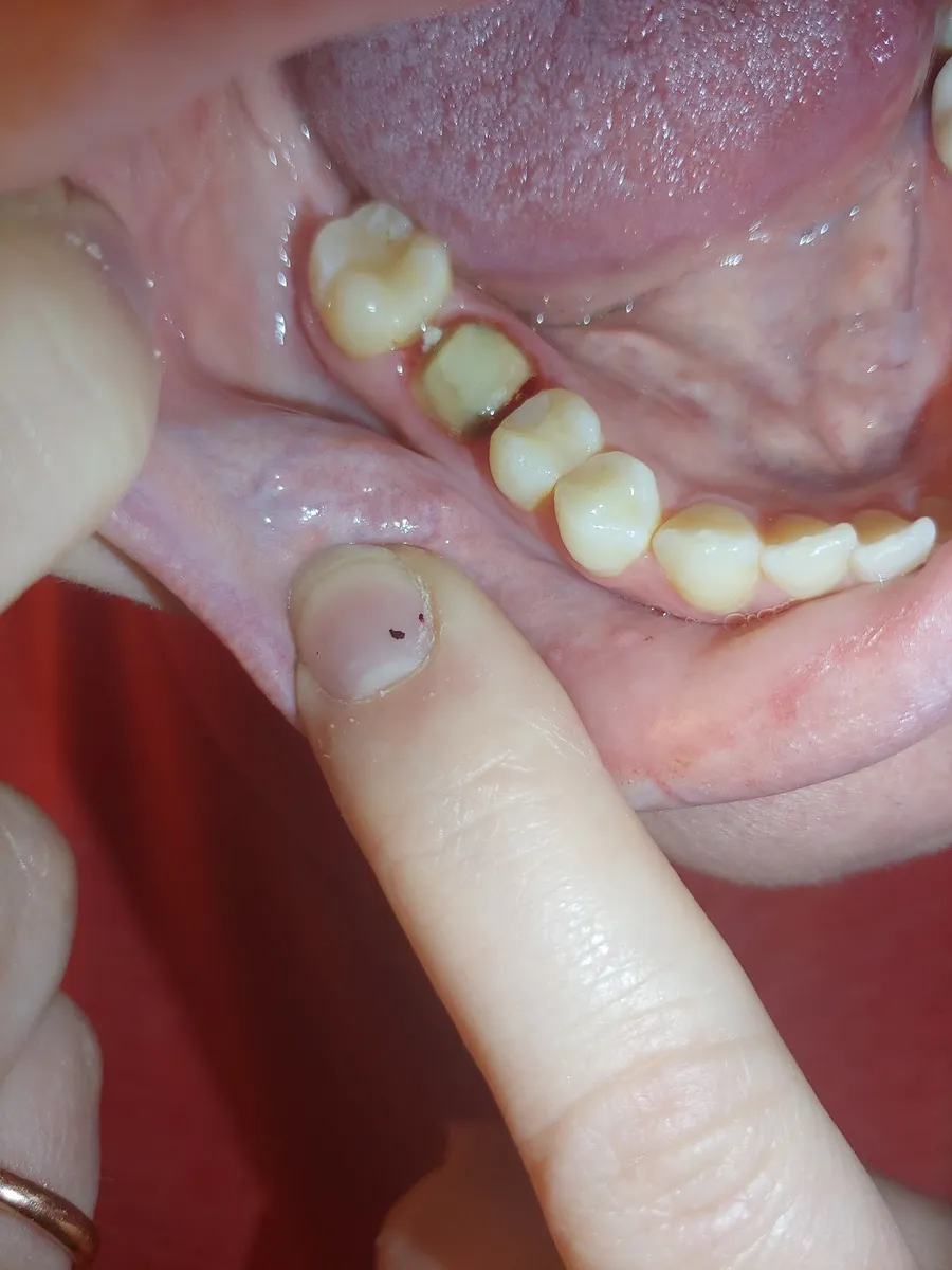 Aspen Dental - Niagara Falls, NY - Photo 4