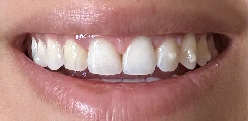 Dr. Stephen Grussmark - Orthodontist in Miami