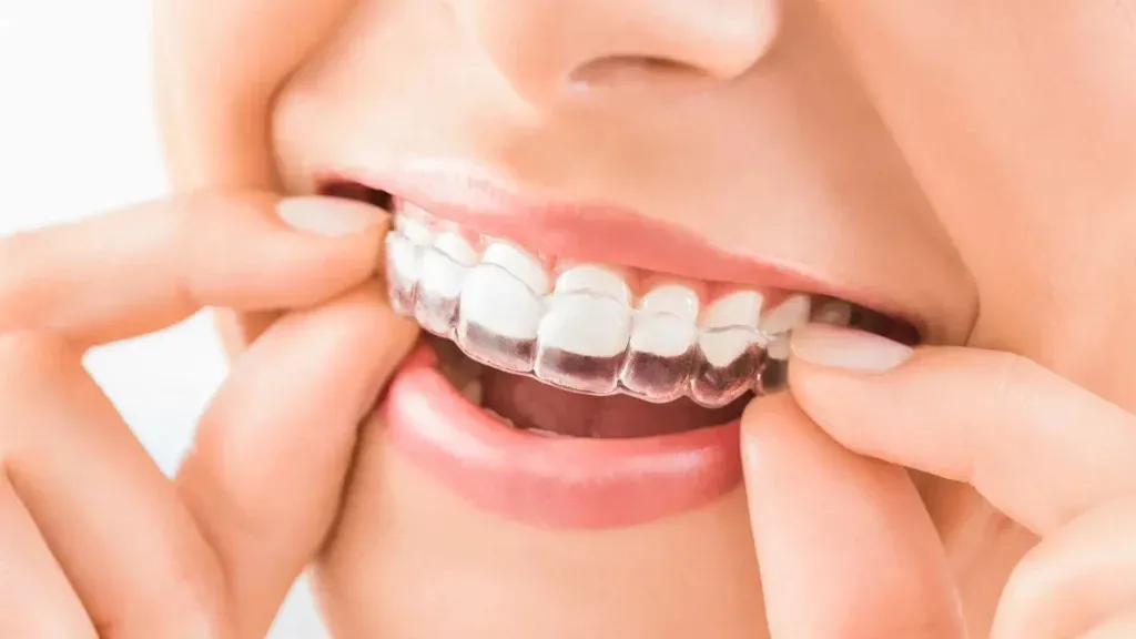 Rocky River Orthodontics - Mooresville - Photo 5