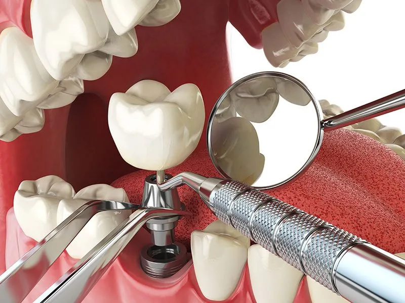 Century Smile Dental - Photo 4