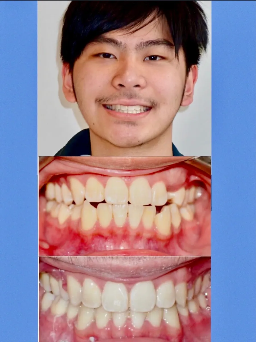 BrushAndFloss Orthodontics - Cary West - Photo 7