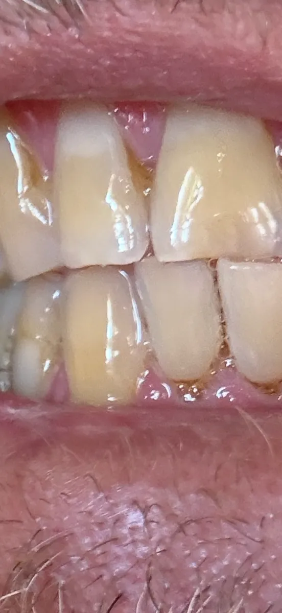 Bright Now! Dental & Orthodontics - Modesto, CA - Photo 5
