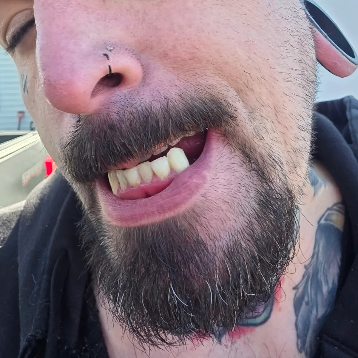 Better Smile - Orthodontist in Buffalo