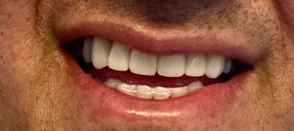 Great Expressions Dental Centers - Bayonne - Photo 5