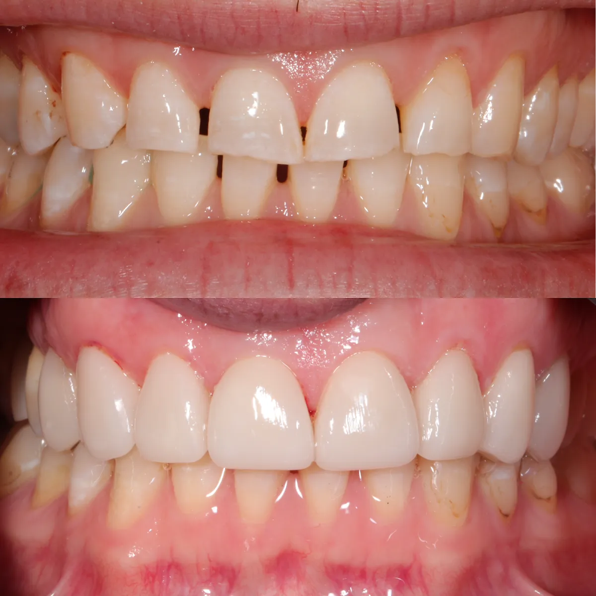 Contour Dentistry - Photo 7