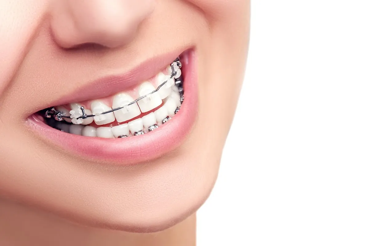Elison & Wood Orthodontics - Photo 7