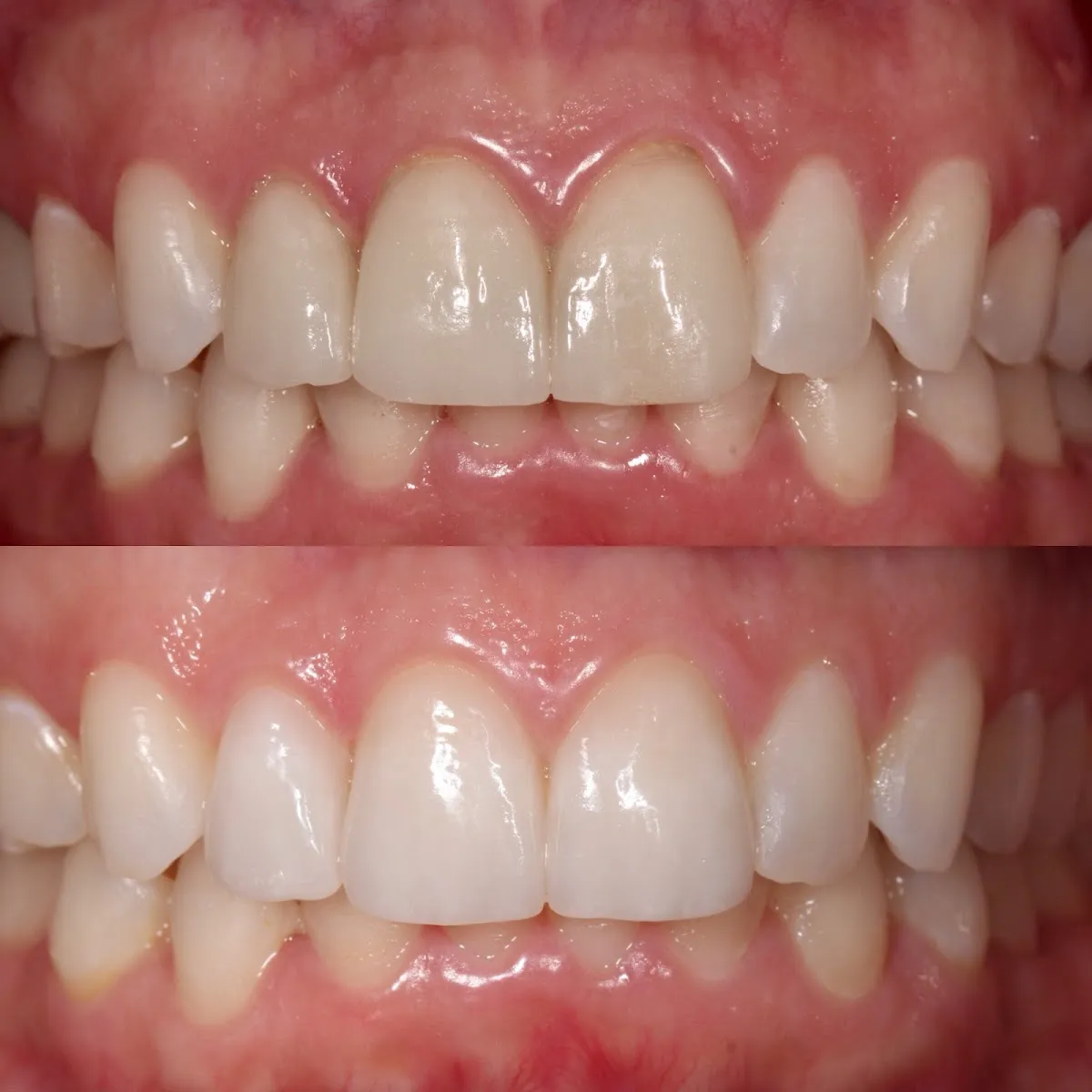 Dentists in Brickell - HQ Dontics Dental Centre