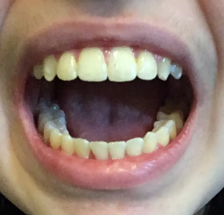 SM Orthodontics. Dr. Morcos BDS., MDS., MSD., PhD. Dr. Michael A. Jack DDS., MS