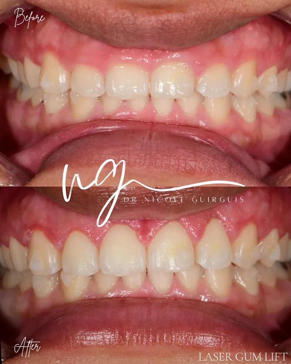 Dentist Near Me Culver City - Photo 2