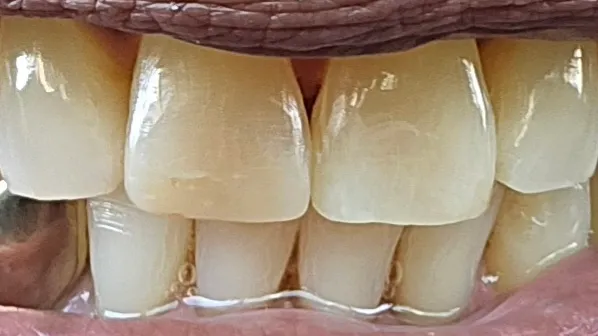 Stonehaven Dental & Orthodontics - Harker Heights - Photo 6