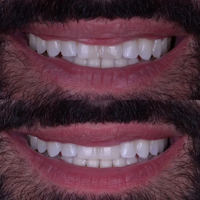 Miami Beach Dental Solutions - Photo 3