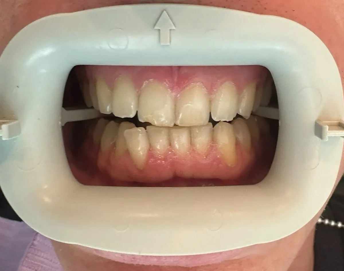 SoFi Dental Care & Orthodontics - Photo 4