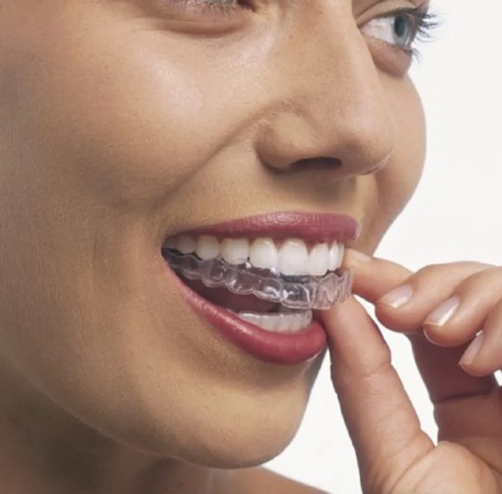 Fox Invisalign And Braces - Orthodontist in Fort Lauderdale